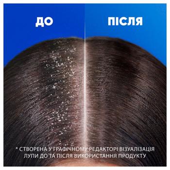 Шампунь Head&Shoulders Цитрусова свіжість 2в1 330мл - купити, ціни на - фото 5