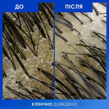 Head&Shoulders Cleansing and Shine Shampoo 400ml - buy, prices for MegaMarket - photo 7